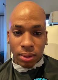 NLE choppa has been harassing Yb continuously tagging him in this lame  song! Yb has matured so much by not responding! He's out here torturing  people with hair. CC… 🫣😂😂😂 👇