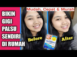 Jun 29, 2021 · aria baron merupakan gitaris gigi pada periode tahun 1994 sampai 1995. Cara Bikin Gigi Palsu Sendiri Di Rumah Ternyata Mudah Banget Youtube