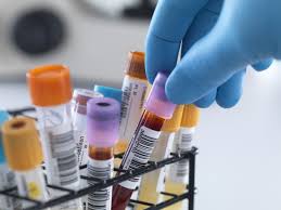 Image result for retention of patient samples in the lab