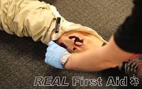Jan 06, 2017 · the information you're talking about is severely outdated; Use Of Tourniquets Real First Aid