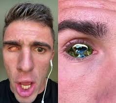 Blue Smurf Cat Filter Eyes