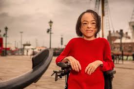 7.5% of people living in south africa have reported living with a disability. Liz Carr Says Disabled Actors Must Be Seen To Change Discrimination They Face Mirror Online