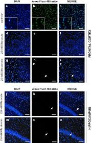 Image result for NBOMe