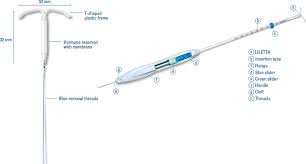 Short speculum may prevent pushing cervix posteriorly. What To Expect When Getting An Iud Teen Health Source