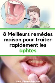 Pin On Astuces Pour Une Bonne Sante