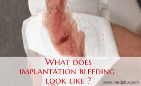 In some cases, this kind of discharge, along with other symptoms, may indicate an infection or any. What Does Implantation Bleeding Look Like Early Pregnancy Pictures