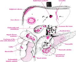 May 27, 2020 · the left upper quadrant (luq) is a section of your tummy (abdomen). Abdominal Pain Differential Diagnosis In Primary Care 4th Edition