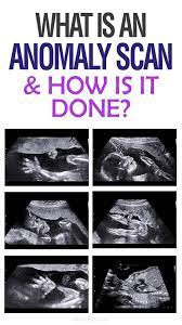 Pin On Ultrasound