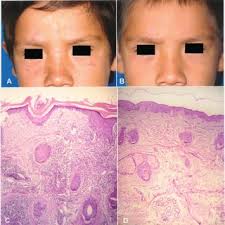 Alberto TLACUILO-PARRA