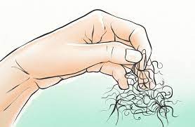 If a hair falls out with a white bulb attached, it cycled through the telogen phase. White Bulb On Hair Follicle A Sign Of Hair Loss Hairguard