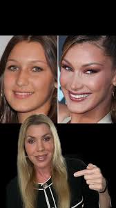 Bella Hadid has model-good looks, but did she always have these striking  features? Let’s take a look! 👩🏼‍⚕️🔎✨