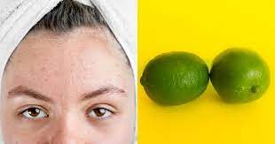 Astringent adalah agen yang menyebabkan kulit menyusut atau menjadi lebih kecil. 5 Cara Menghilangkan Jerawat Pasir Secara Alami Cepat Dan Aman