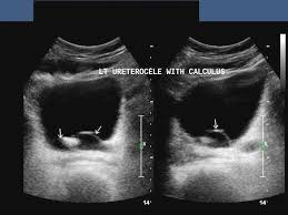 Ultrasound Image Gallery Diagnostic Medical Sonography Ultrasound Medical Imaging