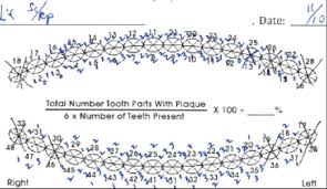 Customized Oral Hygiene Therapy