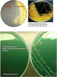 The organism will appear as green colonies on thiosulfate citrate bile salts sucrose (tcbs) agar and will grow in most common media without added nacl. A Brief On Tcbs Agar Tcbs Agar Is Aquaculture Times An International Magazine Facebook