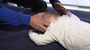 Le syndrome de kiss est d'ailleurs souvent confondu avec le torticolis du nourrisson. Pleurs Inexpliques Bebes Tordus Reflux Et Si C Etait Le Syndrome De Kiss