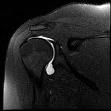 Image result for Shoulder Imaging