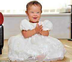 Smile That Melts Misconceptions How Taya Who Was Born With Down S Became The Darling Of The Modelling World Down Syndrome Kids Down Syndrome Baby Down Syndrome