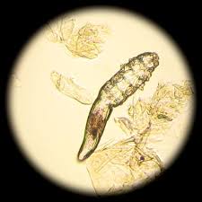 Image result for Demodex brevis