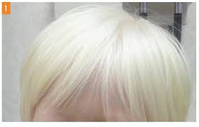 It will, however cause baldness if you pluck all your white hairs when all according to bosley the hair transplant company. What S The Cause Of This Girl S White Hair Milky Skin And Blue Eyes Consultant360