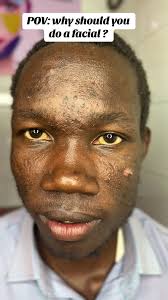 0754531115#fypシ゚ #creatorsearchinsight #skincare #tiktokuganda🇺🇬🇺🇬🇺🇬