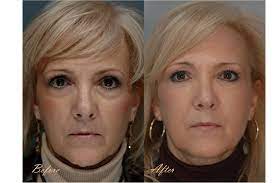 Pin Na Doske Makeup Skin