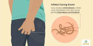 Infeksi Cacing Kremi Gejala Diagnosis Pengobatan