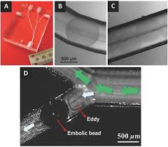 Journal of vascular and interventional radiology. Review Of The Development Of Methods For Characterization Of Microspheres For Use In Embolotherapy Translating Bench To Cathlab Caine 2017 Advanced Healthcare Materials Wiley Online Library