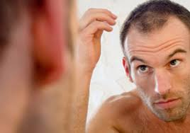 نتیجه تصویری برای ریزش مو