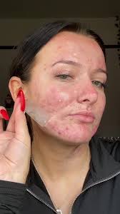 Biker Removes Prospect Patch