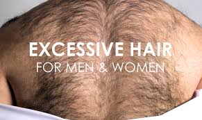 Finally, postmenopausal females can experience hair growth due to sudden changes in hormonal levels without experiencing any other health concerns. Excessive Or Unwanted Hair In Men Women Premier Clinic