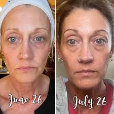 Ageless Face Wand and Eye Wand Review and Results