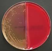 Play with millions of players around the world and try to become the biggest cell of all! Mibius Col Cna Asculin S Nb Mcconkey 3 Mod Agar 10 Kombiplatten Mikrobiologie Onlineshop Merck Sartorius Oxoid Neogen Acumedia Fachhandel