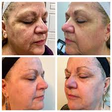 TOP 10 BEST Spray Tanning near Irmo, SC 29063