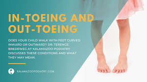 Image result for Out-toeing