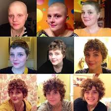 Cheers To One Year Of Health Hair Growth After Chemo Growing Hair After Chemo Hair Regrowth Women