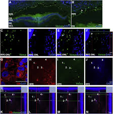Preclinical Evaluation Of A Cell Based Gene Therapy Using The Sleeping Beauty Transposon System In Choroidal Neovascularization Molecular Therapy Methods Clinical Development
