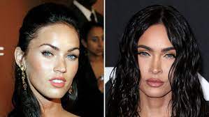 Spine surgery is a medical procedure where an incision is made into the body to correct the spine and relieve the patient from back and neck pains. Megan Fox Plastic Surgery Has She Gone Under The Knife