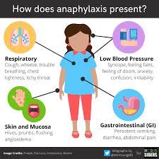 Image result for Anaphylaxis