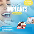Dental implant product image