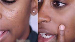 How To Minimize Large Pores! #Fixitfriday | Jackie Aina - Youtube