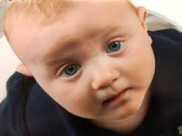 RASopathies Network USA News Post