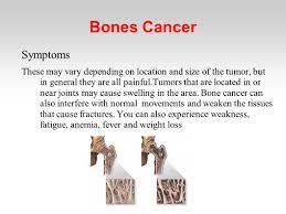 Check spelling or type a new query. Bones Cancer The Primary Bone Cancer Is A Rare Type Of Cancer That Affects The Human Skeleton Unlike The Secondary Originates In The Bone And Not The Ppt Download