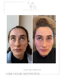 Johnnie Rivera (@johnnierivera_rn) • Instagram photos and videos