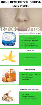 To use apple cider vinegar as a toner, dilute vinegar with water, apply to a cotton ball and swab your face. 3 Effective Home Remedies To Shrink Large Open Pores On The Skin Skincare Skinpores Homeremedies Face Skin Skin Care Remedies Skin Pores Skin Care