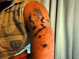 Green ink is the most resistant to laser treatment. Day 1 Tattoo Removal E Raze Rejuvi Non Lazer Reading Berkshire Video Blog 1 1 A Bit Brighter Youtube