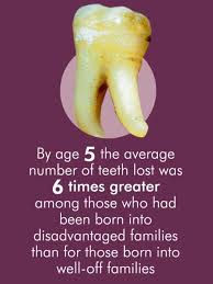 The cost of wisdom tooth removal can vary depending on the complexity. Wisdom Tooth Extraction Cost Nz Teethwalls