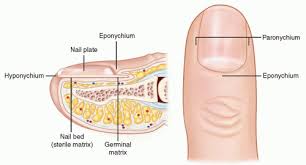 Image result for paronychium