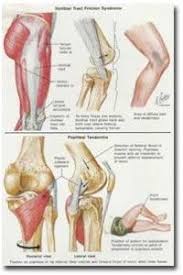 Pin On Running Injuries