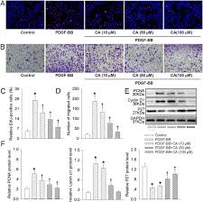 For example, a publicly held company with 10 million shares outstanding that trade at $10 each would have a market capitalization of $100 million. Chicoric Acid Prevents Pdgf Bb Induced Vsmc Dedifferentiation Proliferation And Migration By Suppressing Ros Nfkb Mtor P70s6k Signaling Cascade Sciencedirect